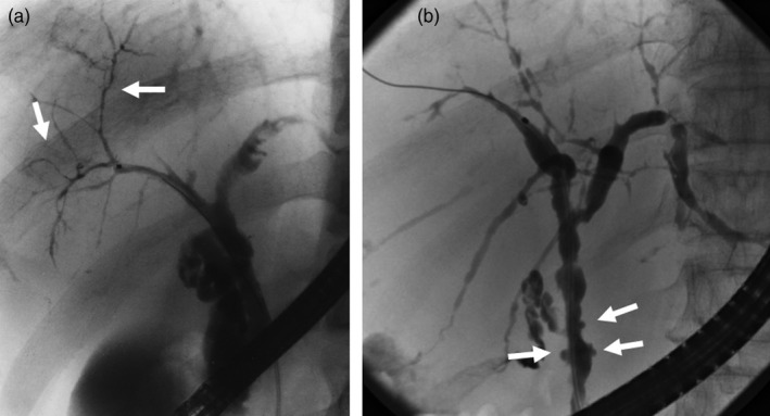 Figure 22