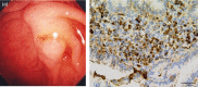 Figure 26