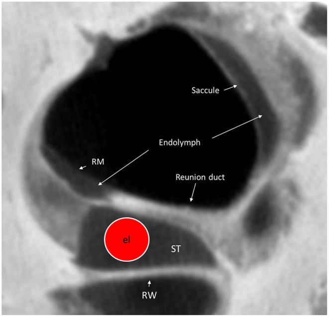 Figure 10