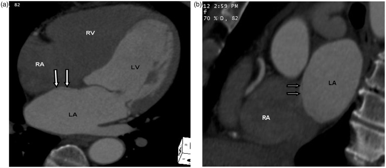 Fig. 10.