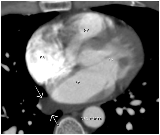 Fig. 23.