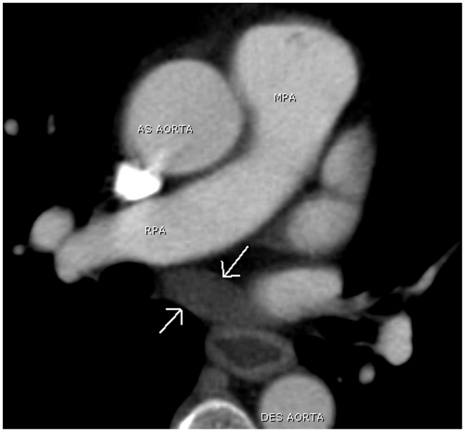 Fig. 22.