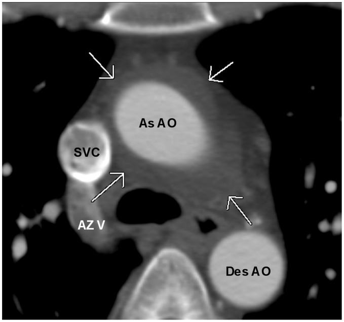 Fig. 20.