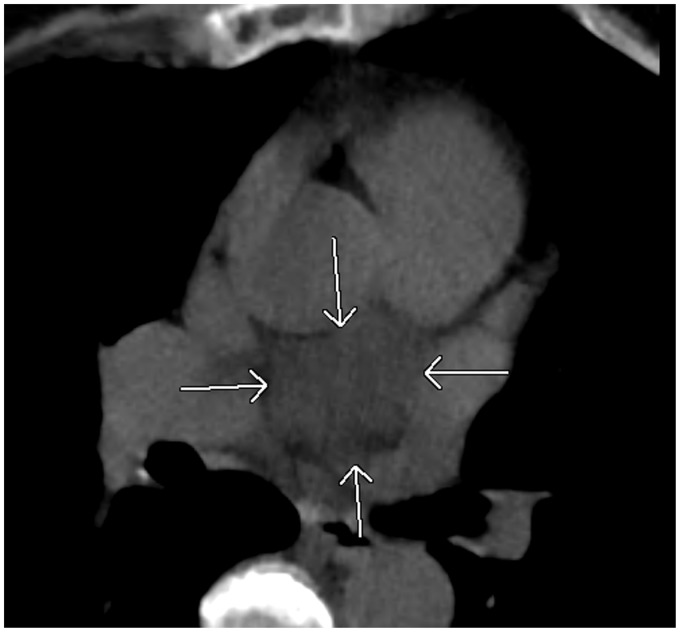 Fig. 21.