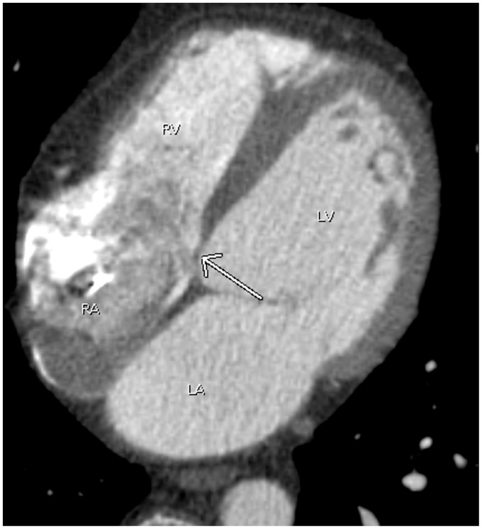 Fig. 17.