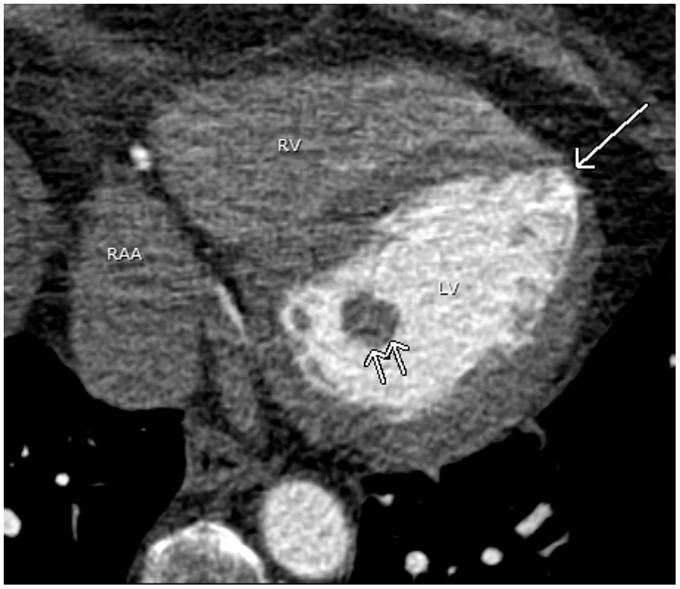 Fig. 16.