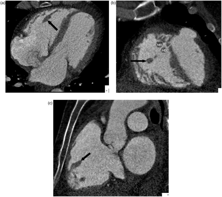 Fig. 13.