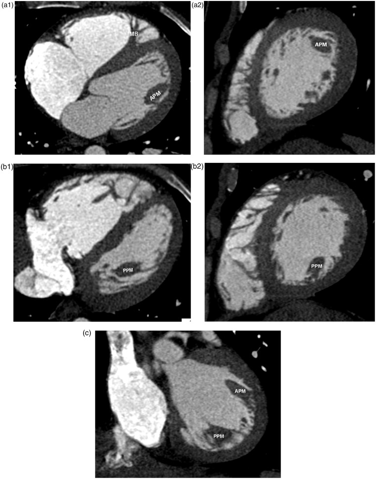 Fig. 15.