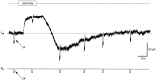 Fig. 12.