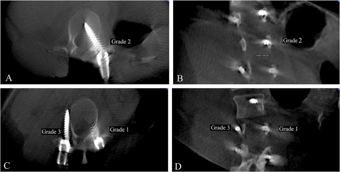 Fig. 1A-D