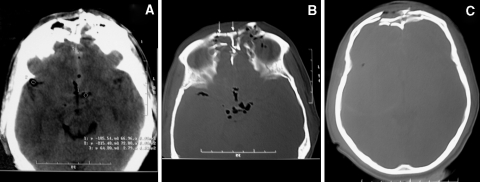 Fig. 1