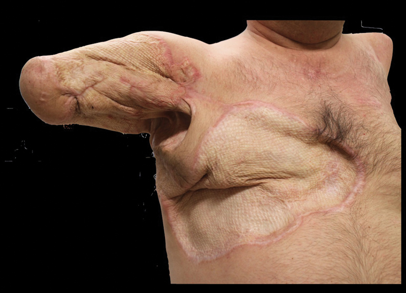 Fig. 8