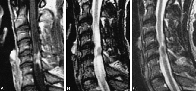 fig 6.