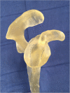 Fig. 11