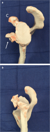 Fig. 12