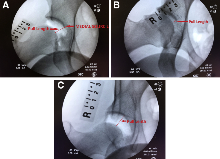 Fig 3