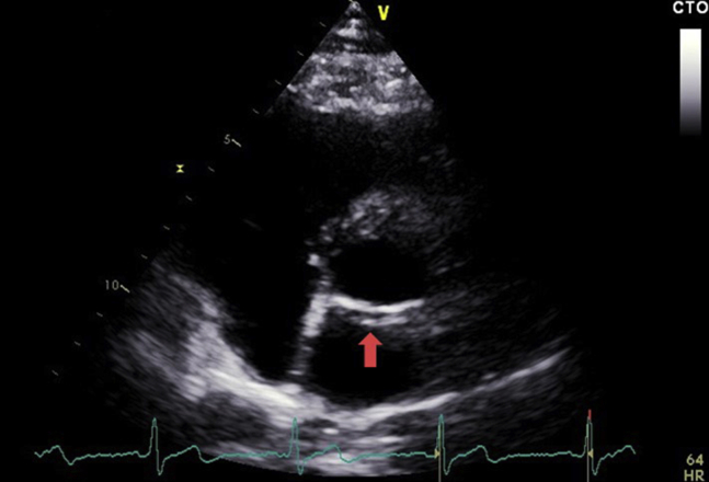 Figure 3