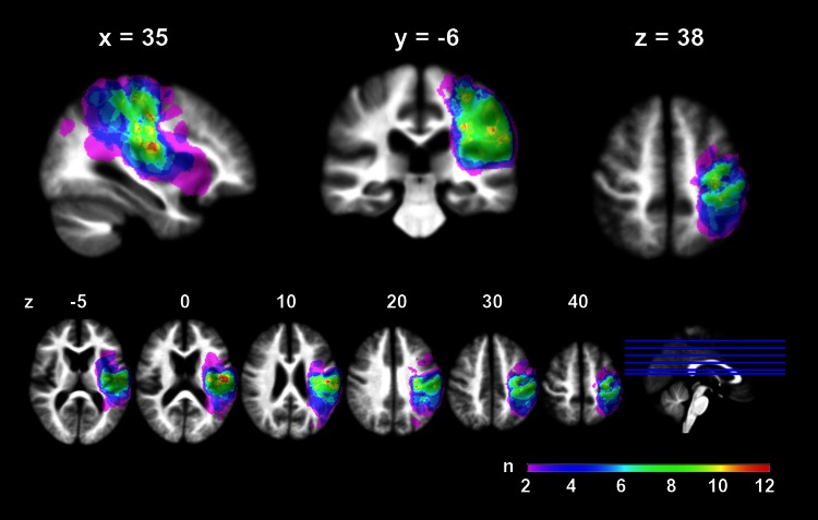 Fig. 2