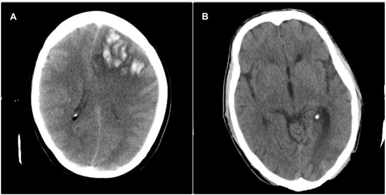 Fig. 1