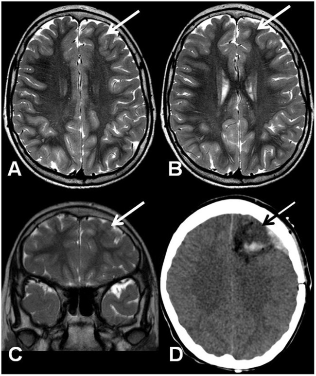 FIGURE 1