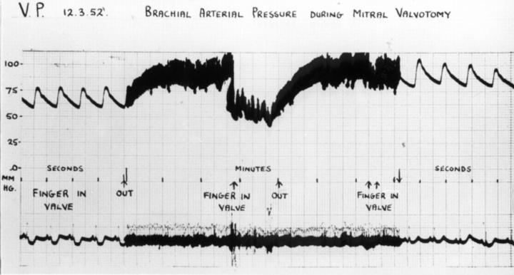 Figure 5  