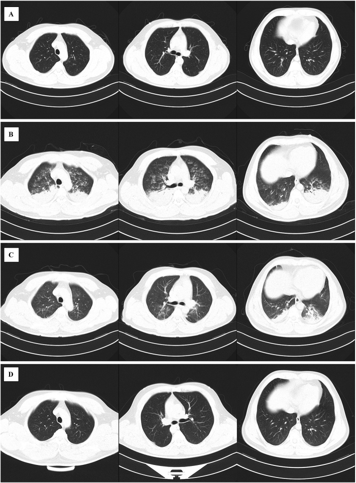 Fig. 2