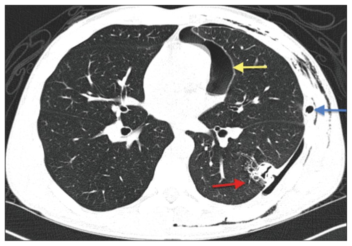 Figure 2: