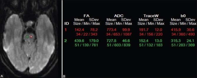 Figure 3(A and B)