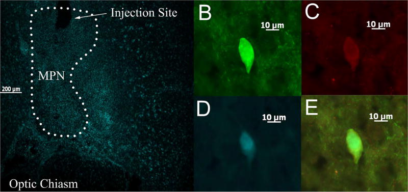 Figure 2