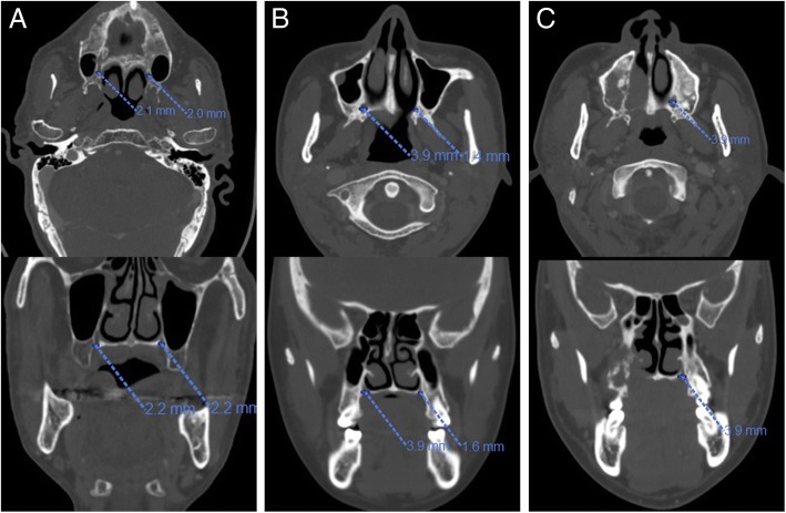 Fig. 2