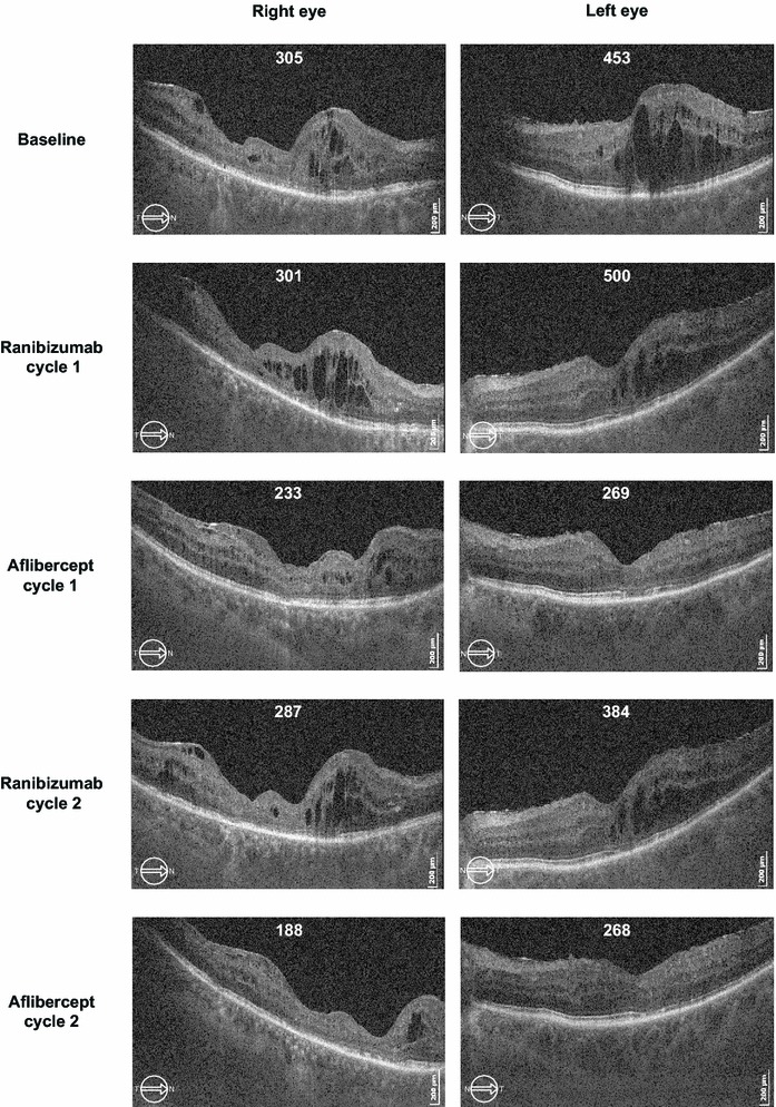 Fig. 4