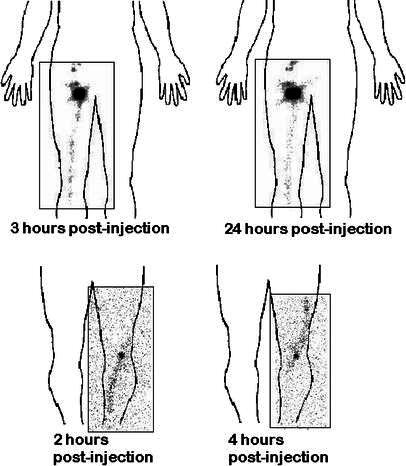 Fig. 6A, B.