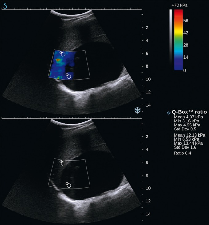 Fig. 4