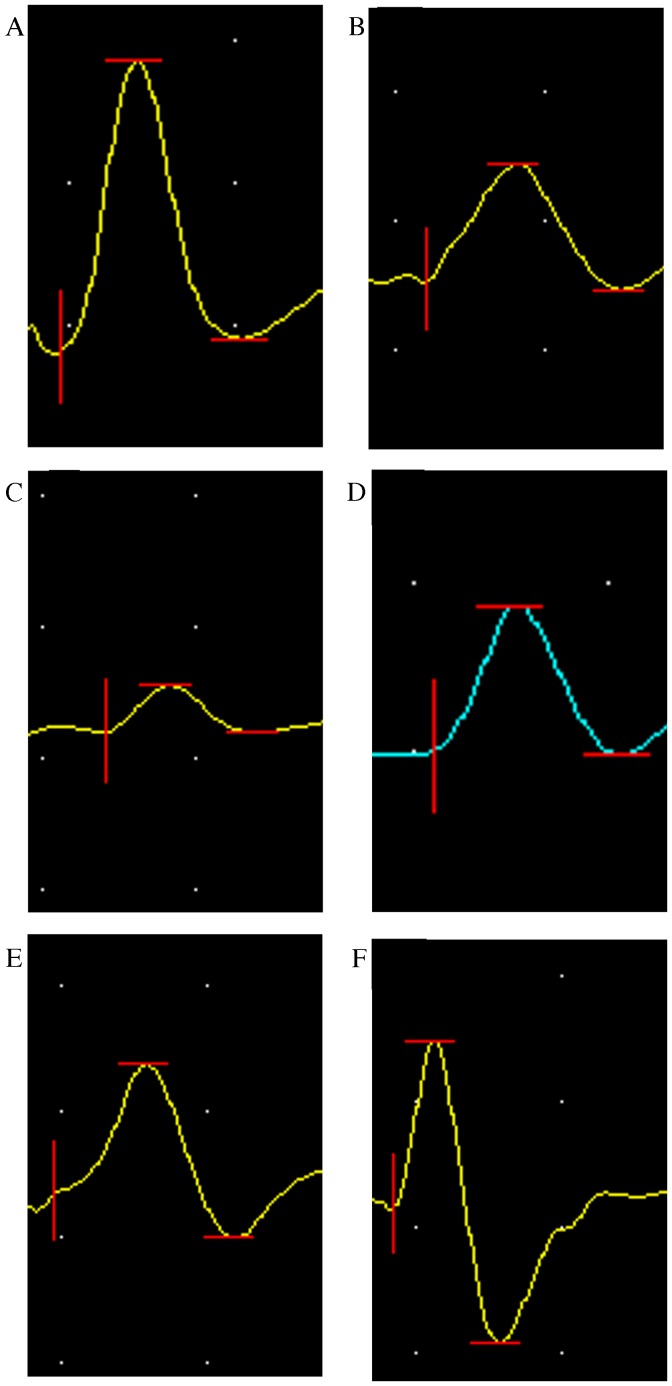 Figure 6.