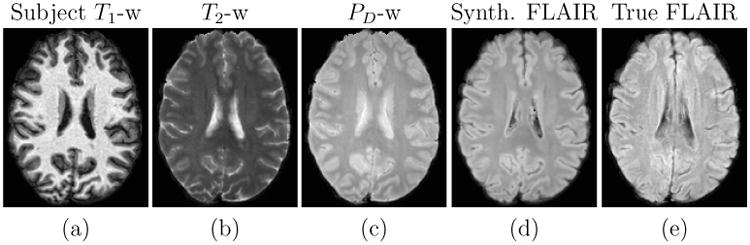 Figure 11