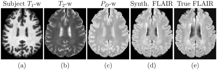 Figure 12