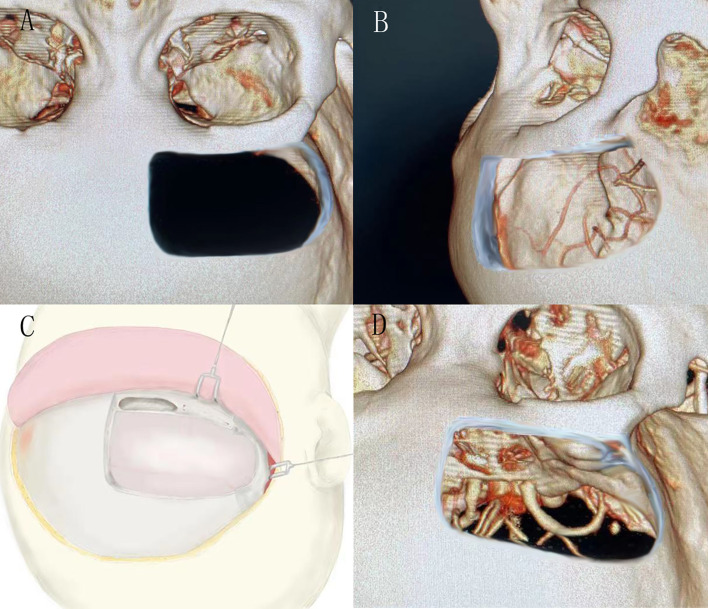 Figure 1