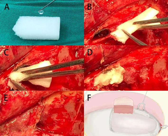 Figure 2