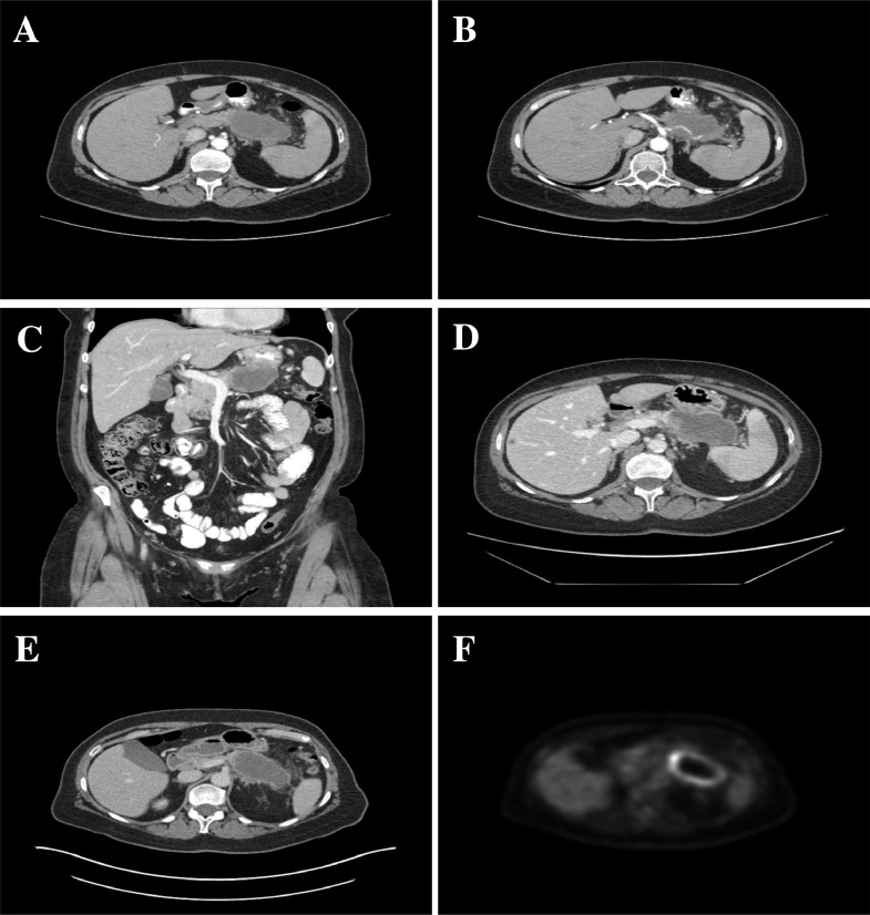 Fig 1 –