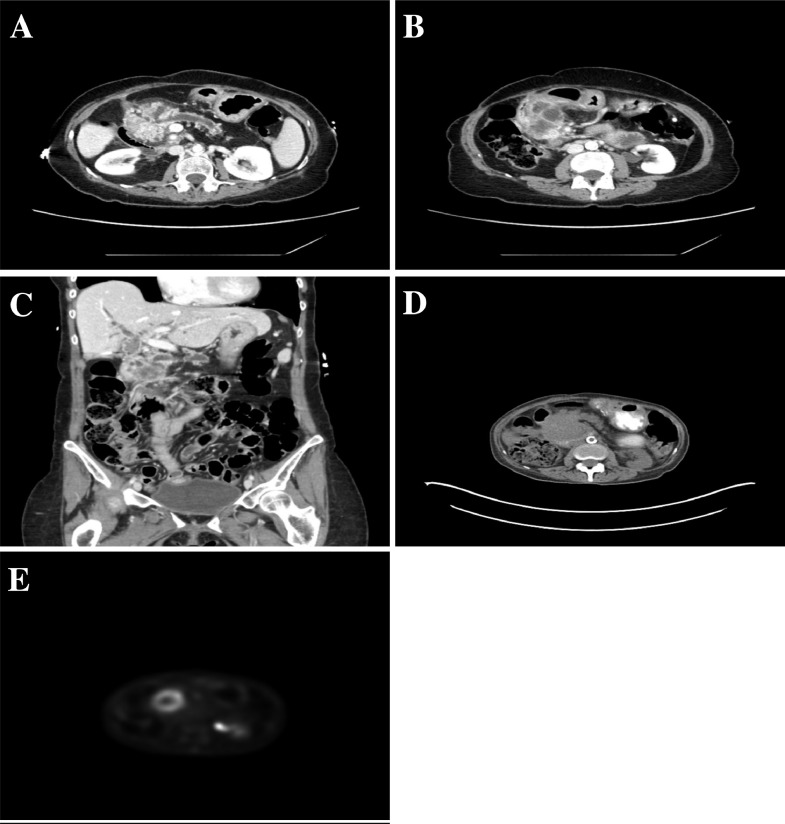 Fig 2 –