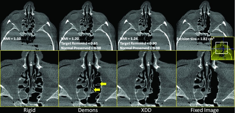 Figure 12