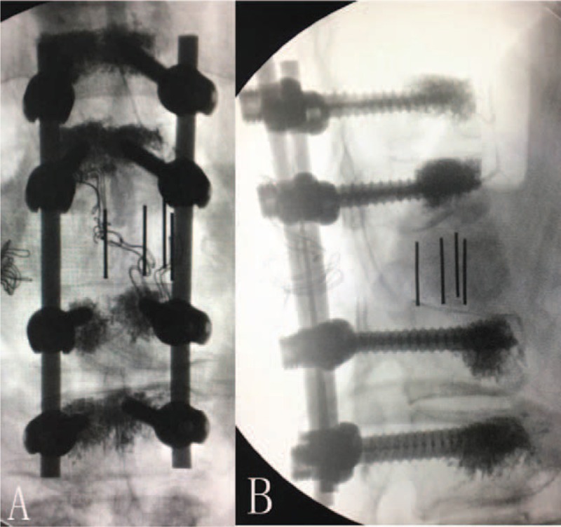 Figure 9