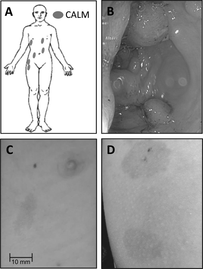 Fig. 1