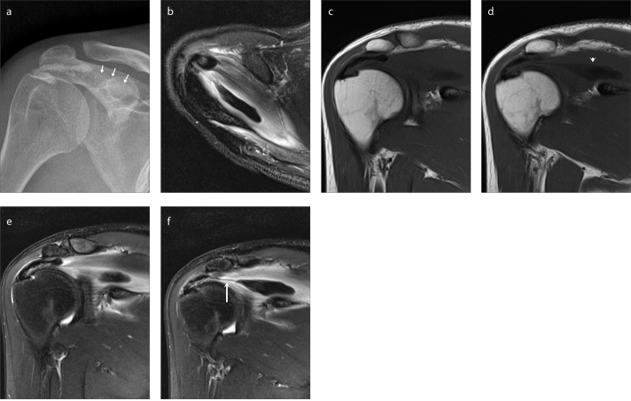 Figure 2. a–f