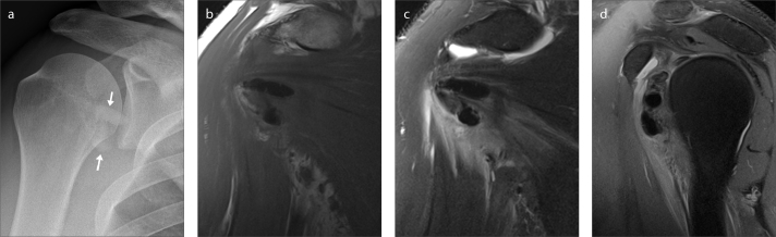Figure 3a–d