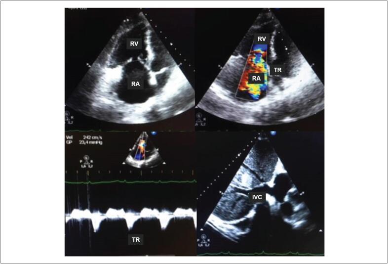 Figure 21