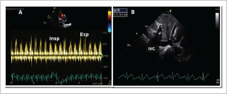 Figure 30