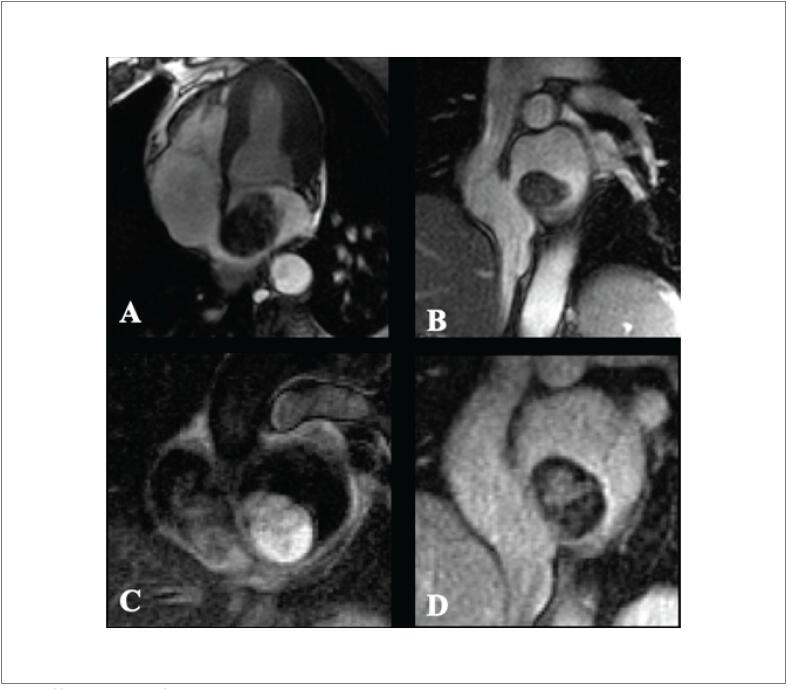 Figure 14