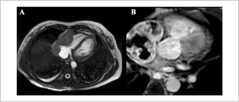 Figure 19