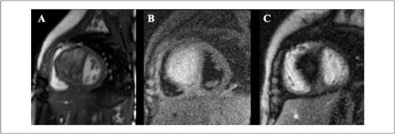 Figure 17